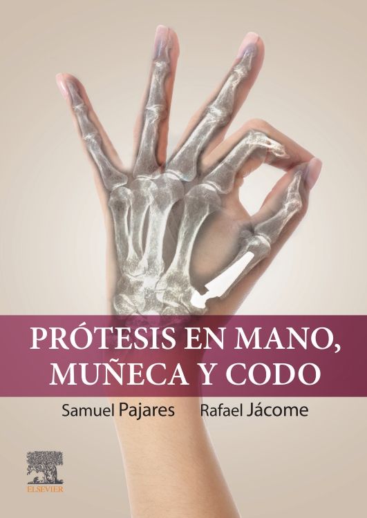 PAJARES, S.- PROTESIS EN MANO, MUÑECA Y CODO, 1Ed., 2024