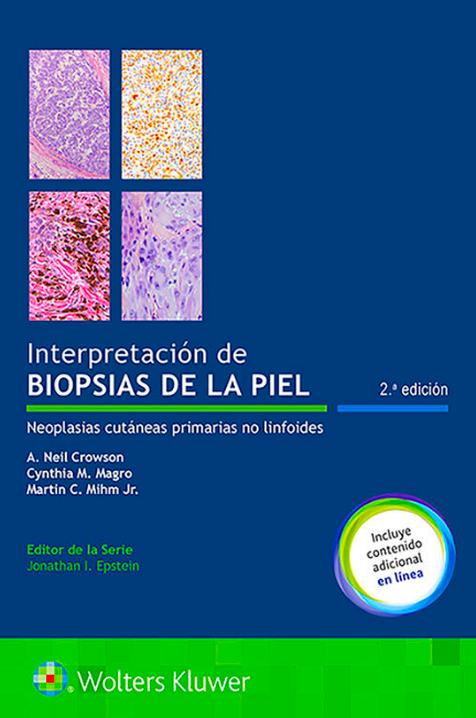 CROWSON- INTERPRETACION DE BIOPSIA DE LA PIEL, 2.¦ Ed. 2020