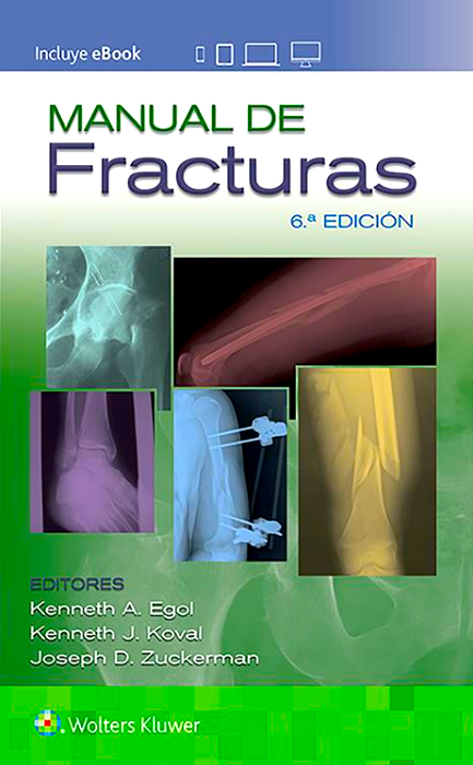 EGOL- MANUAL DE FRACTURAS, 6.¦ Ed. 2020