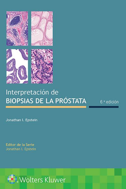 EPSTEIN- INTERPRETACION DE BIOPSIAS DE LA PROSTATA, 6.¦ Ed. 2021