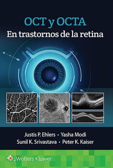 EHLERS- OCT Y ANGIOGRAFIA DE OCT EN TRASTORNOS DE LA RETINA, 1.¦Ed. 2021