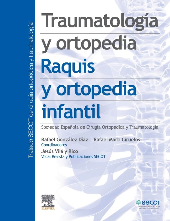 SECOT- TRAUMATOLOGIA PEDIATRICA, 1Ed., 2022