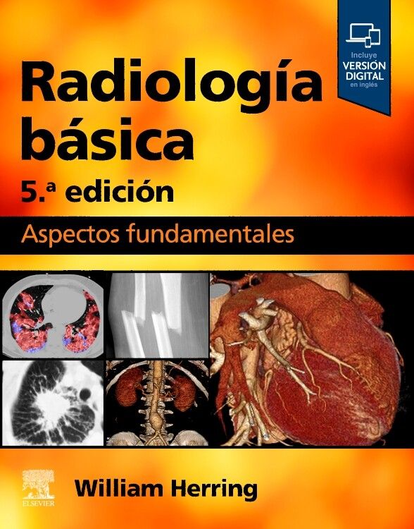 HERRING, W.- RADIOLOGIA BASICA, 5Ed., 2024
