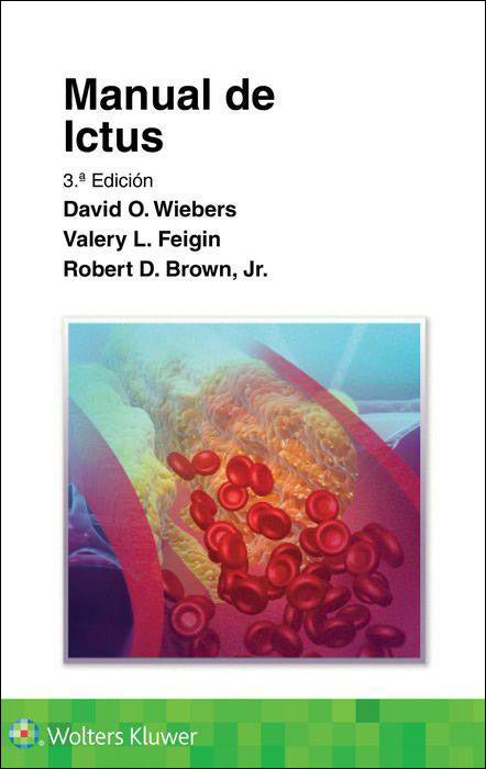 WIEBERS- MANUAL DE ICTUS, 3Ed.  2022