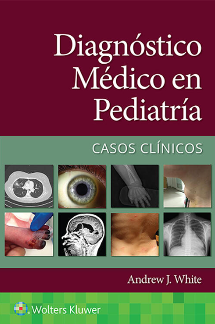 WHITE- DIAGNOSTICO MEDICO EN PEDIATRIA. CASOS CLINICOS, 1.¦Ed.  2022
