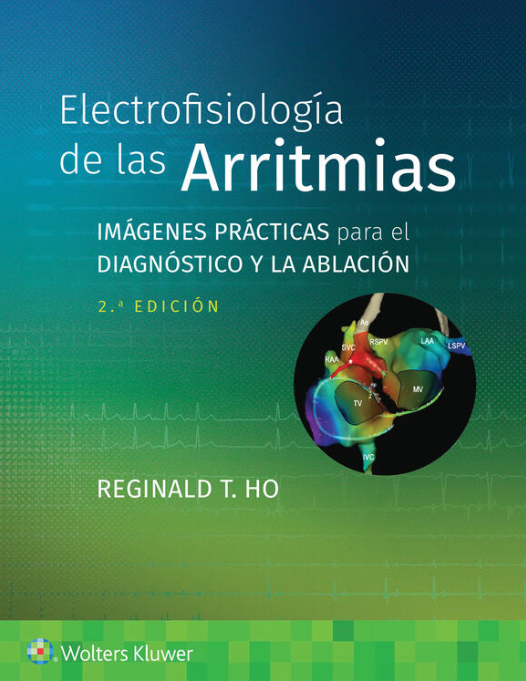 HO- ELECTROFISIOLOGIA DE LAS ARRITMIAS. IMAGENES PRACTICAS PARA EL DIAGNOSTICO Y LA ABLACION, 2.¦Ed.  2023