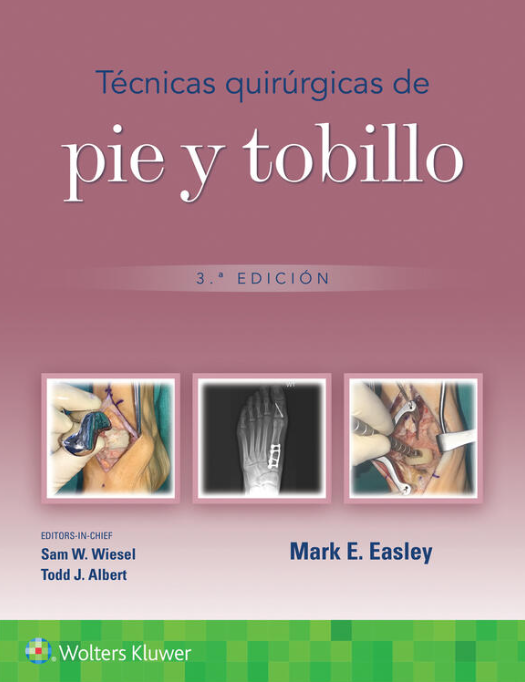 EASLEY- TECNICAS QUIRURGICAS DE PIE Y TOBILLO, 3.¦Ed.  2024