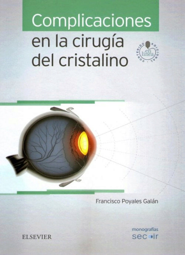 POYALES GALAN, F.- COMPLICACIONES EN LA CIRUGIA DEL CRISTALINO, 1Ed., 2016