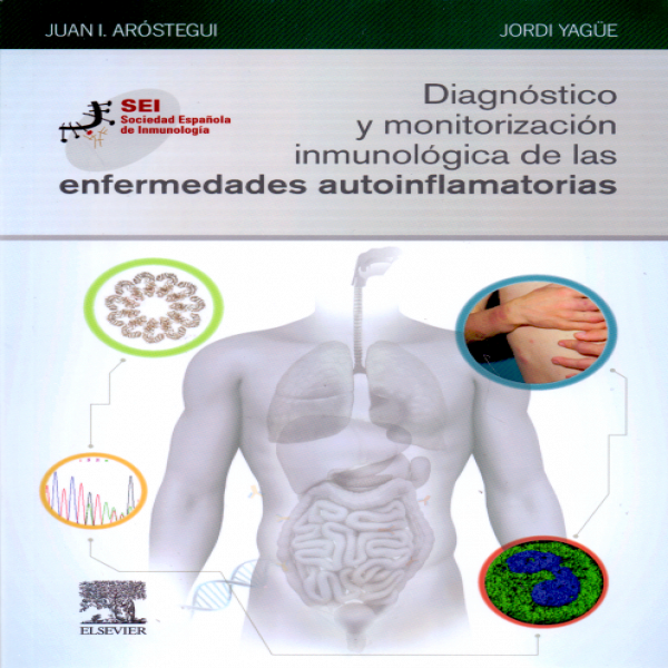 AROSTEGUI GOROSPE. J.I.- DIAGNOSTICO Y MONITORIZACION INMUNOLOGICA DE LAS ENFERMEDADES AU, 1Ed., 2019