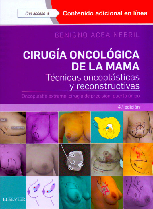 ACEA NEBRIL, B.- CIRUGIA ONCOLOGICA DE LA MAMA, 4Ed., 2018