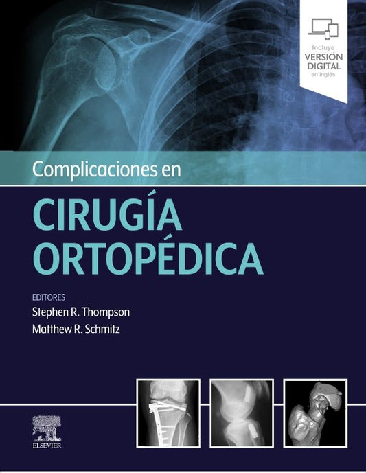 THOMPSON, S.R.- COMPLICACIONES EN CIRUGIA ORTOPEDICA, 1Ed., 2021