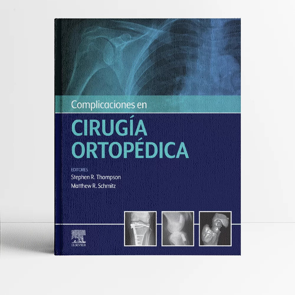 THOMPSON, S.R.- COMPLICACIONES EN CIRUGIA ORTOPEDICA, 1Ed., 2021