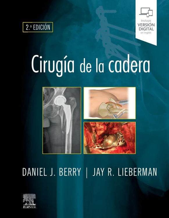 BERRY, D. J.- CIRUGIA DE LA CADERA, 2Ed., 2021